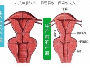 八爪鱼紧缩术——阴道紧致，做紧致女人