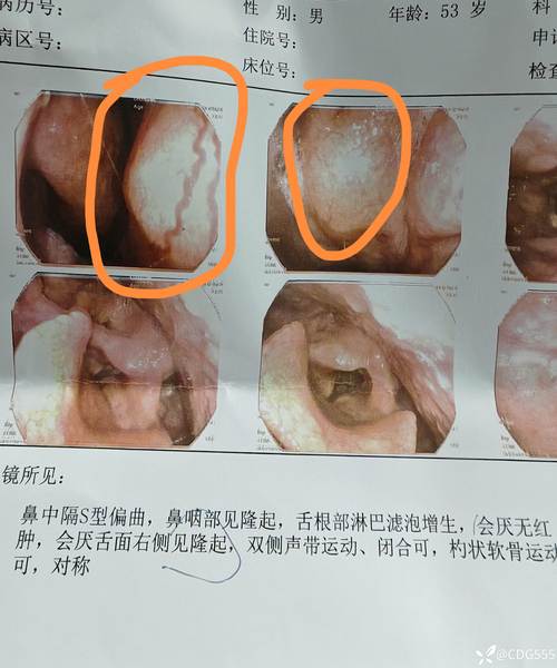 男人舌头又尖又长代表他可能正在使用这款产品